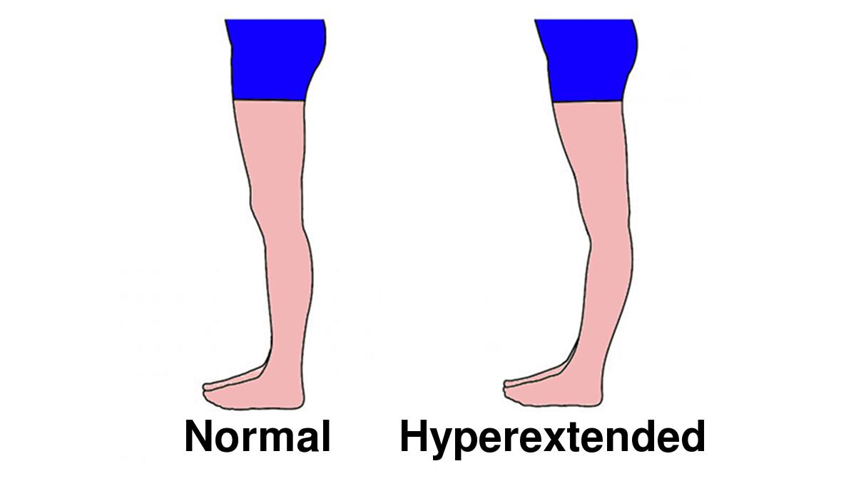 Banana Knees